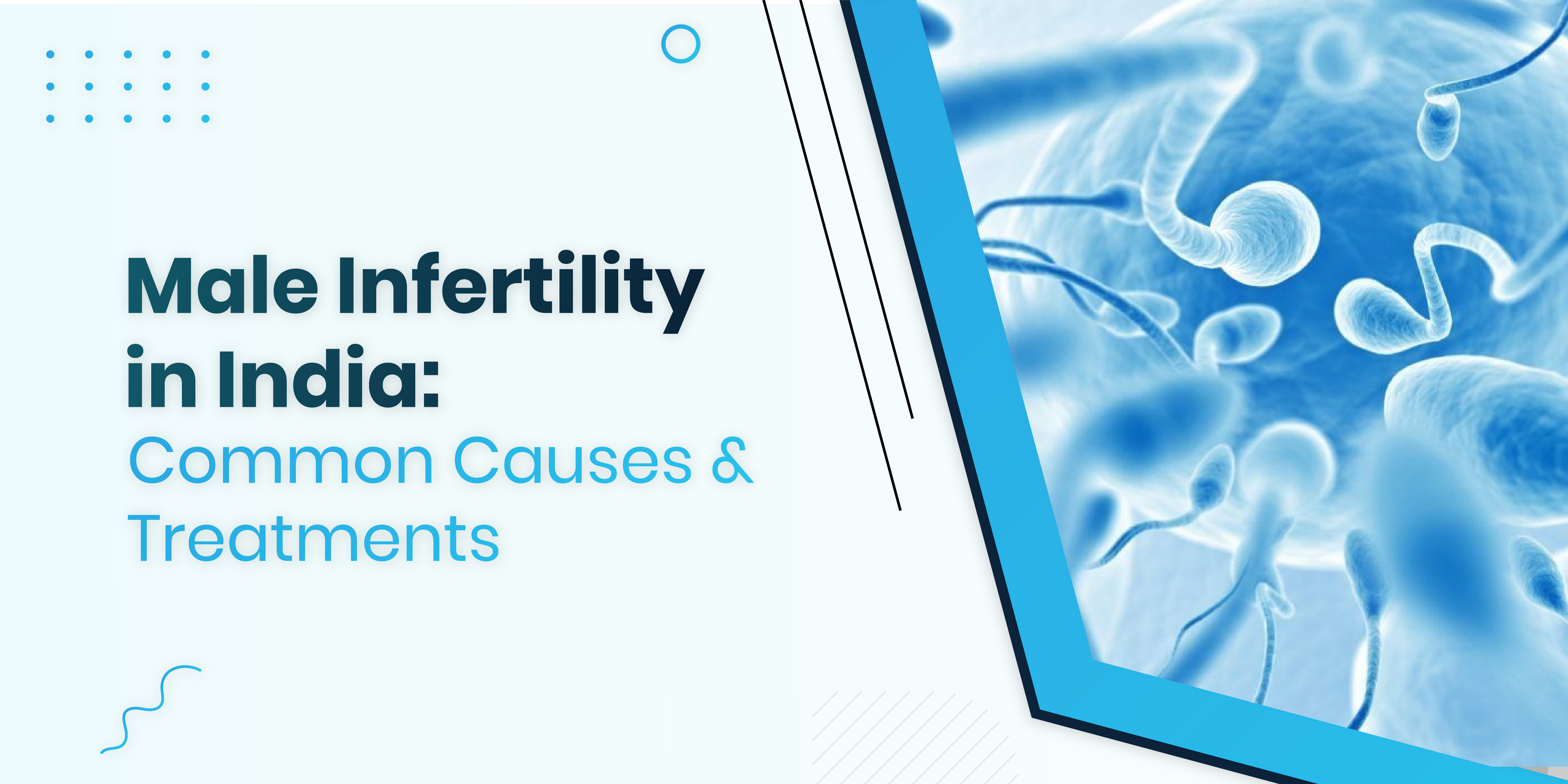 Male Infertility in India: Prevalent Causes & Treatment