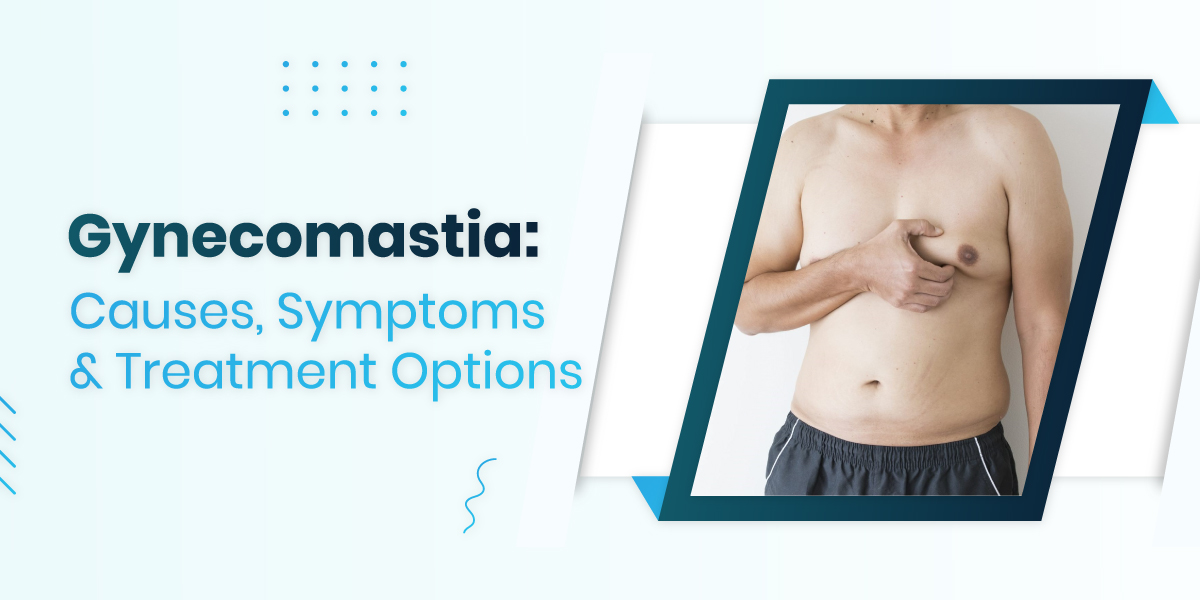 Gynecomastia: Causes, Symptoms & Treatment Options