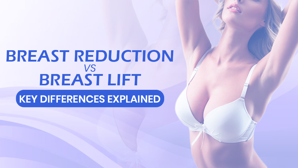 Breast Reduction vs. Breast Lift – Key Differences Explained