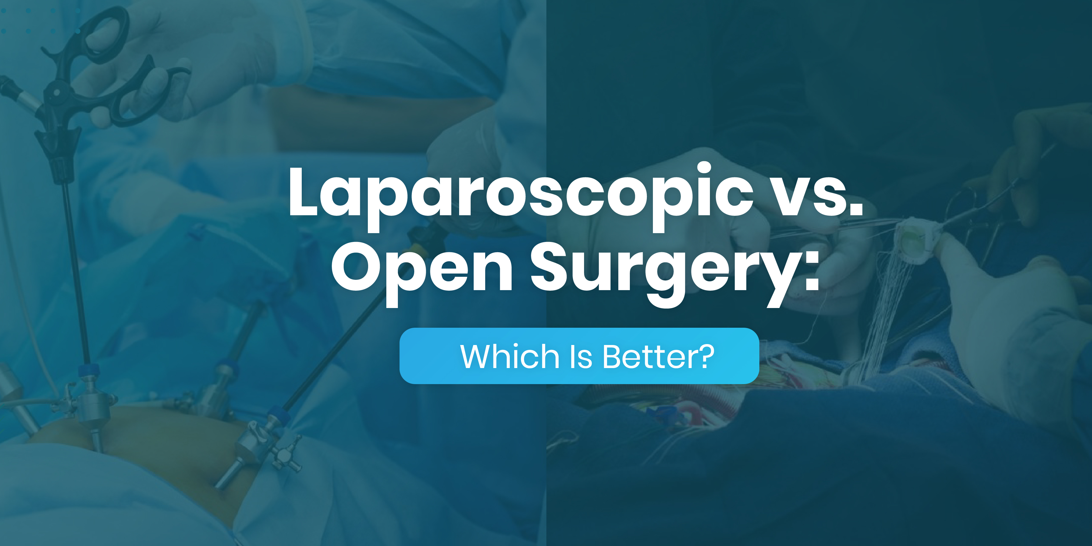 Laparoscopic vs Open Surgery - Which Is Better?