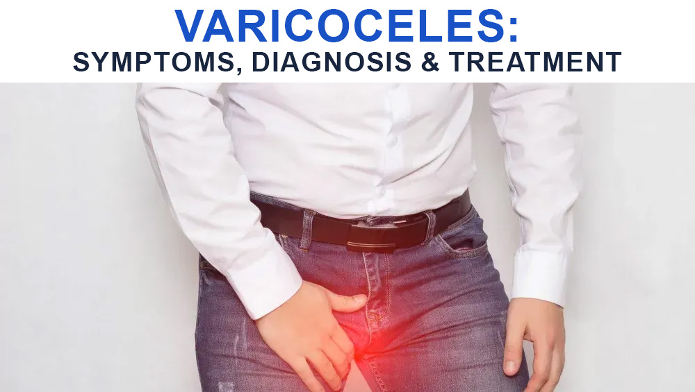 Varicoceles: Symptoms, Diagnosis & Treatment